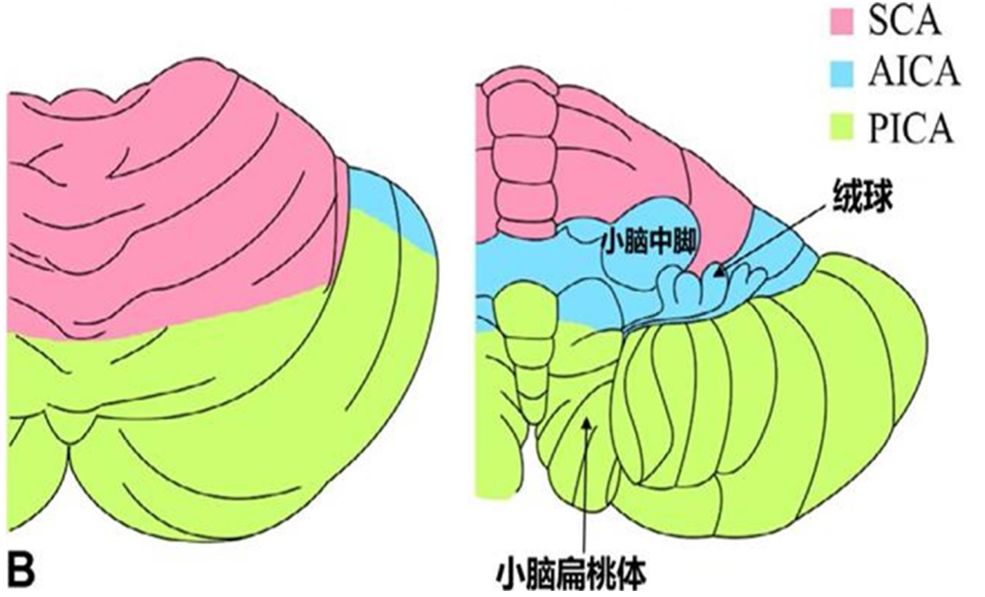 小脑蚓部_小脑蚓部症状体征_小脑蚓部图像